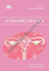 Endometrioza 