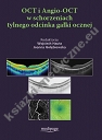 OCT i Angio-OCT w schorzeniach tylnego odcinka gałki ocznej