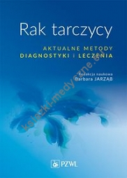 Rak tarczycy Aktualne metody diagnostyki i leczenia