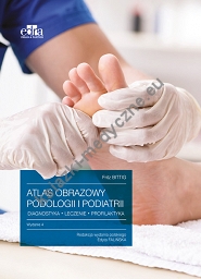 Atlas obrazowy podologii i podiatrii Diagnostyka, leczenie, profilaktyka