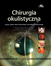 Chirurgia okulistyczna