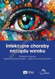 Infekcyjne choroby narządu wzroku