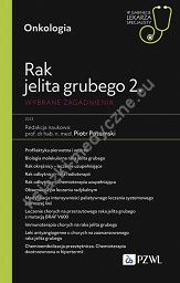 Rak jelita grubego 2. Wybrane zagadnienia