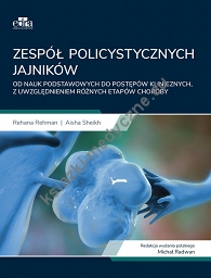 Zespół policystycznych jajników