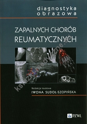 Diagnostyka obrazowa zapalnych chorób reumatycznych